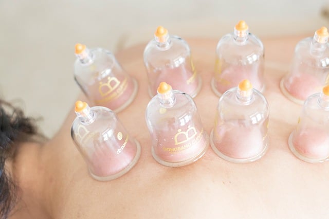 cupping therapy questions